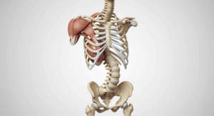 Why Fixing Scoliosis is Essential for Your Health